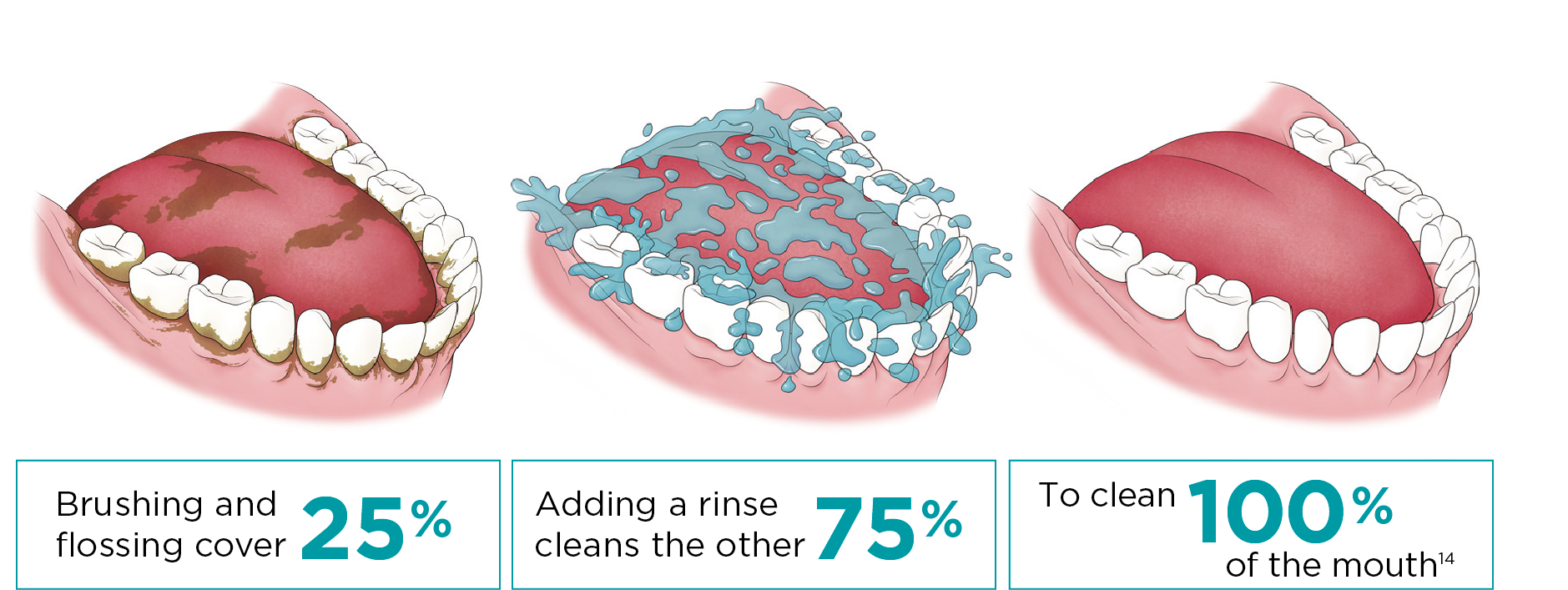 Brushing and flossing cover 25% Adding a rinse cleans 75% for a 100% whole mouth clean