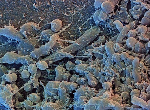 Microscopic image of oral microbiome bacteria