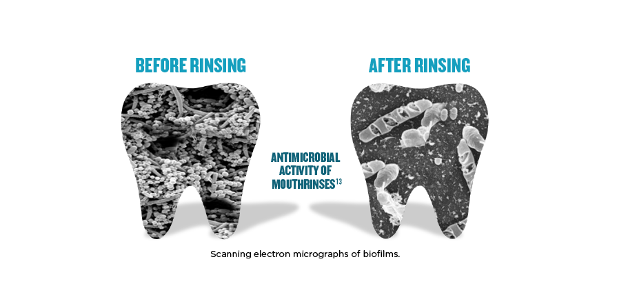 Microscopic image of oral microbiome bacteria before rinsing and after rinsing.